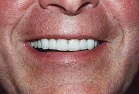 Man's smile with white healthy teeth