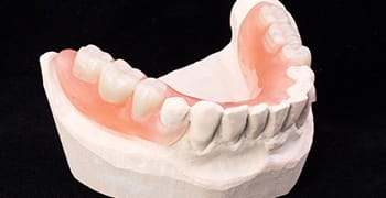 Partial denture on tooth model