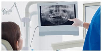 Dentist pointing to x-ray on monitor