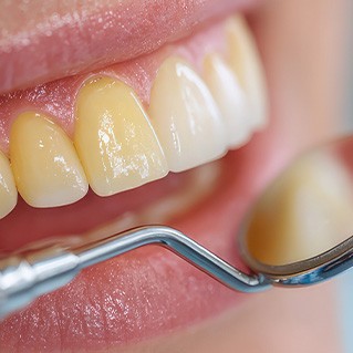 Dental mirror next to yellow teeth