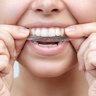 Person placing teeth whitening strip on her teeth