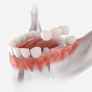 An illustration of a traditional bridge  