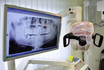 Panoramic dental x-ray displayed on chairside monitor