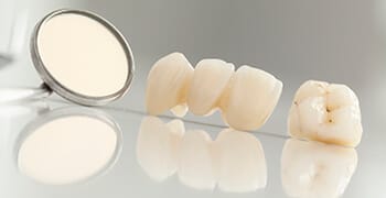 Dental crown and bridge prosthetic on table