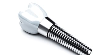 benefits of dental implants in Tallahassee