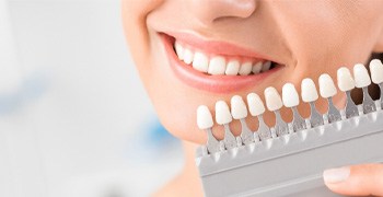 Color-matching patient’s teeth for smile makeover in Tallahassee, FL