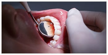 Patient being examined for oral cancer