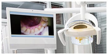 Images of patient's teeth on chairside monitor