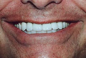 Completely perfect brilliantly white smile