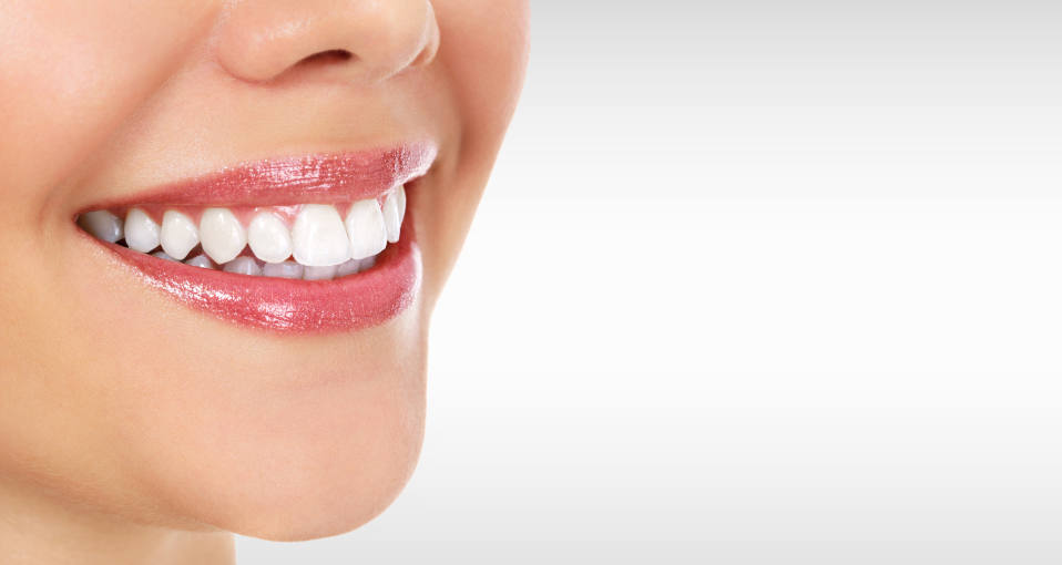Close up of a woman's bright white smile